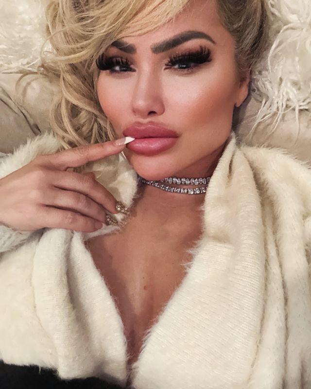 Darcey Silva stuns her fans with her new chin implant