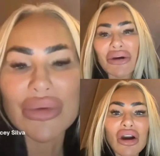 Darcey Silva’s Raw Images Are Unsettling Her Fans